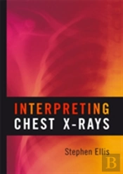 Interpreting Chest X-Rays