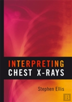 Bertrand.pt - Interpreting Chest X-Rays