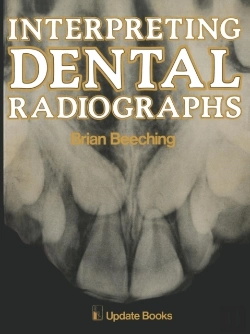 Bertrand.pt - Interpreting Dental Radiographs