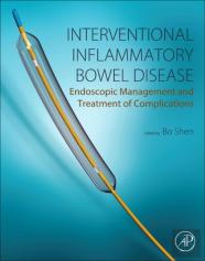 Interventional Inflammatory Bowel Diseases: Endoscopic Management And Treatment Of Complications