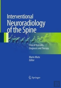 Bertrand.pt - Interventional Neuroradiology Of The Spine