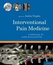 Interventional Pain Medicine