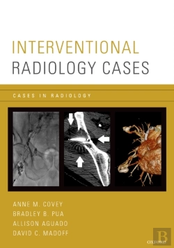 Bertrand.pt - Interventional Radiology Cases