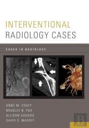 Interventional Radiology Cases