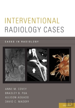 Bertrand.pt - Interventional Radiology Cases