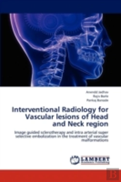 Bertrand.pt - Interventional Radiology For Vascular Lesions Of Head And Neck Region