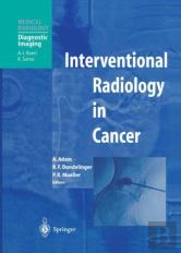 Interventional Radiology In Cancer