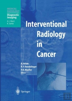 Bertrand.pt - Interventional Radiology In Cancer