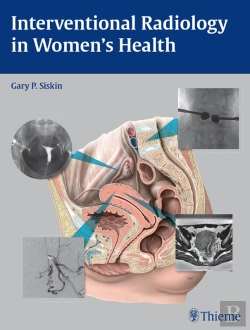 Bertrand.pt - Interventional Radiology In Women'S Health