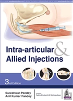 Bertrand.pt - Intra-Articular & Allied Injections