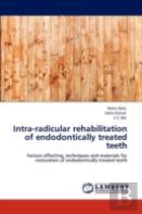 Intra-Radicular Rehabilitation Of Endodontically Treated Teeth