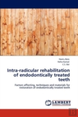 Bertrand.pt - Intra-Radicular Rehabilitation Of Endodontically Treated Teeth