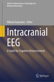 Intracranial Eeg