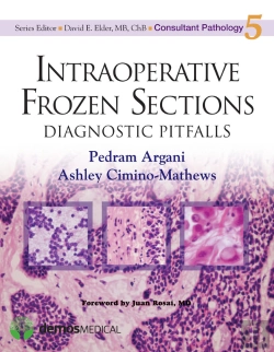 Bertrand.pt - Intraoperative Frozen Sections