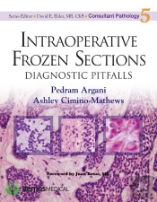 Intraoperative Frozen Sections