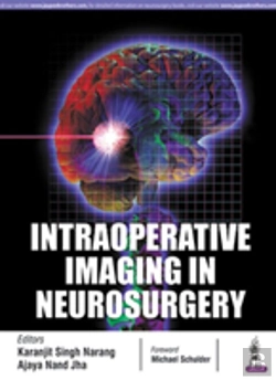 Bertrand.pt - Intraoperative Imaging In Neurosurgery