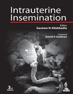 Bertrand.pt - Intrauterine Insemination