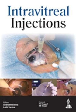 Bertrand.pt - Intravitreal Injections