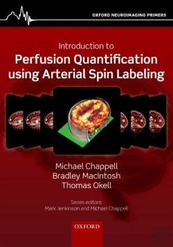 Bertrand.pt - Introduction To Perfusion Quantification Using Arterial Spin Labelling