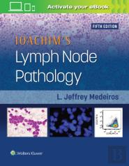 Ioachim'S Lymph Node Pathology