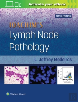 Bertrand.pt - Ioachim'S Lymph Node Pathology
