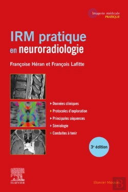 Bertrand.pt - Irm Pratique En Neuroradiologie