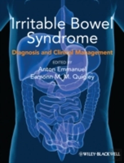 Bertrand.pt - Irritable Bowel Syndrome: Diagnosis And Clinical Management