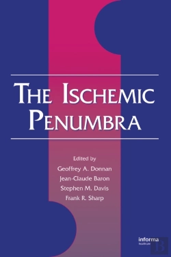 Bertrand.pt - Ischemic Penumbra