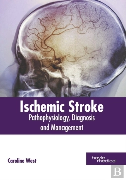 Bertrand.pt - Ischemic Stroke