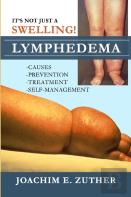 It'S Not Just A Swelling! Lymphedema