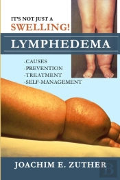It'S Not Just A Swelling! Lymphedema