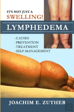 Bertrand.pt - It'S Not Just A Swelling! Lymphedema