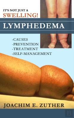 Bertrand.pt - It'S Not Just A Swelling! Lymphedema