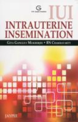 Bertrand.pt - Iui Intrauterine Insemination