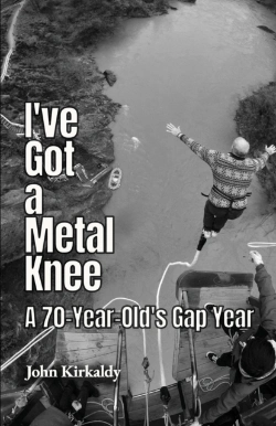 Bertrand.pt - I'Ve Got A Metal Knee