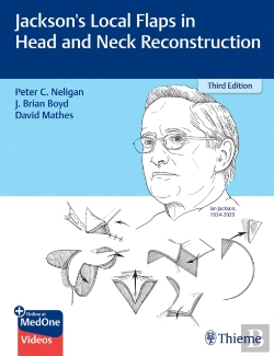 Bertrand.pt - Jackson'S Local Flaps In Head And Neck Reconstruction