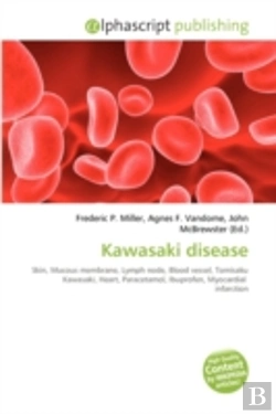 Bertrand.pt - Kawasaki Disease
