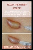 Keloid Treatment Secrets
