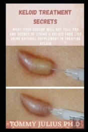 Keloid Treatment Secrets