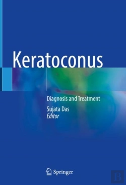 Bertrand.pt - Keratoconus