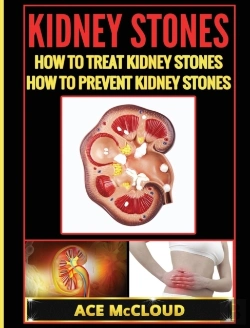 Bertrand.pt - Kidney Stones