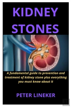 Bertrand.pt - Kidney Stones