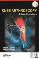 Knee Arthroscopy