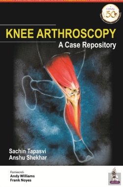 Bertrand.pt - Knee Arthroscopy