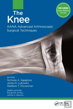 Bertrand.pt - Knee