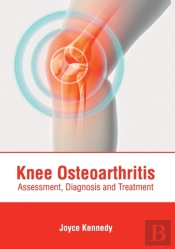 Knee Osteoarthritis: Assessment, Diagnos