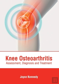 Bertrand.pt - Knee Osteoarthritis: Assessment, Diagnos