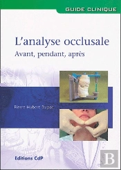 L Analyse Occlusale Avant Pendant Apres
