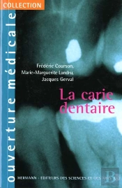 La Carie Dentaire