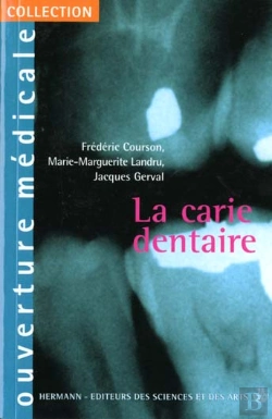 Bertrand.pt - La Carie Dentaire